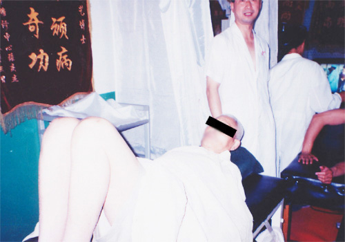 脊髓型颈胸腰椎病